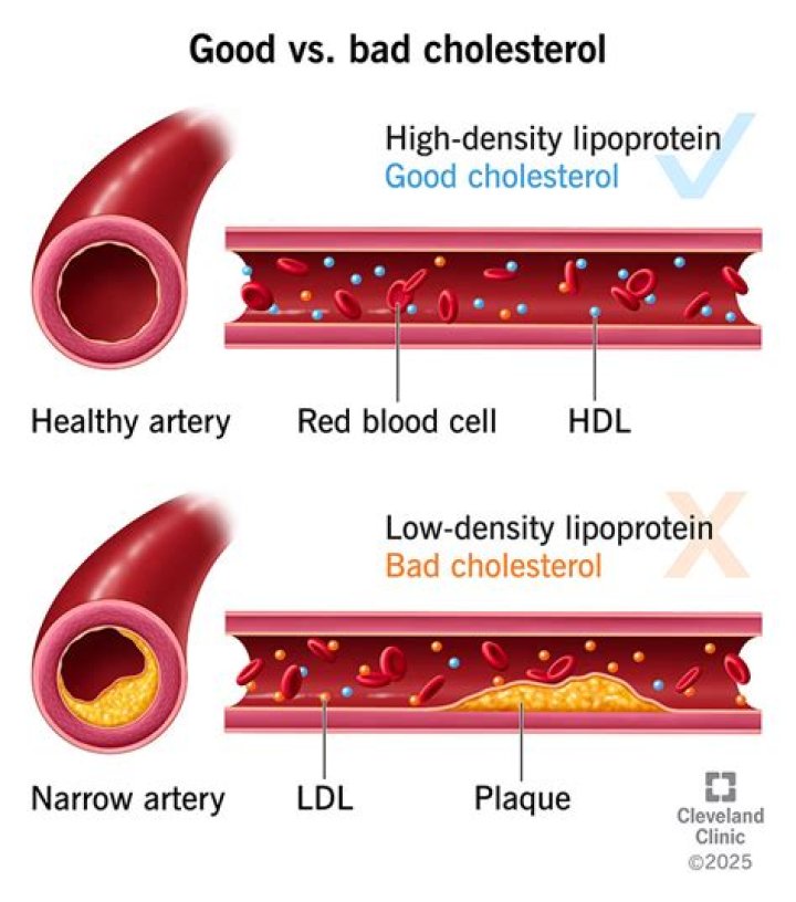 Can one meal raise cholesterol?