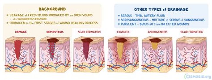 What does black skin around a wound mean?