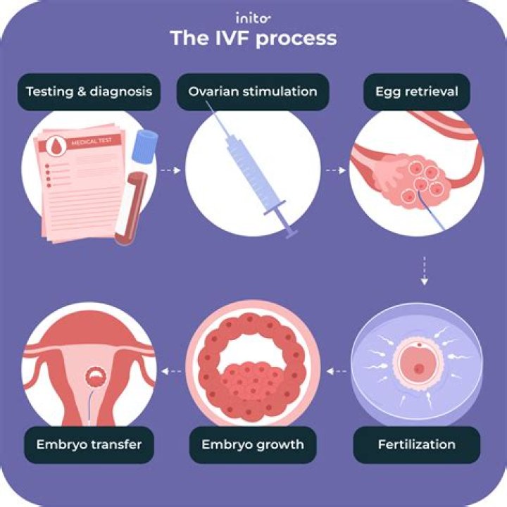 What does IVF feel like?
