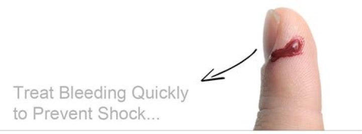 Why do I pick my fingers until they bleed?